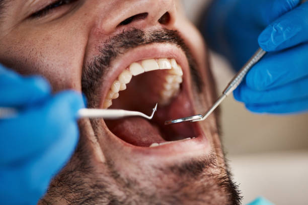 Best After-Hours Dental Trauma Care in Traverse City, MI