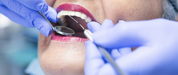 Best Emergency Tooth Extraction in Traverse City, MI